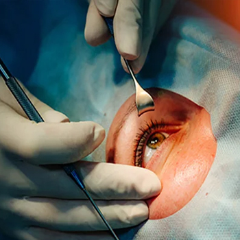 Eyecare